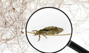 Wszy w snach – co oznaczają? Znaczenie i interpretacja marzeń sennych o wszach