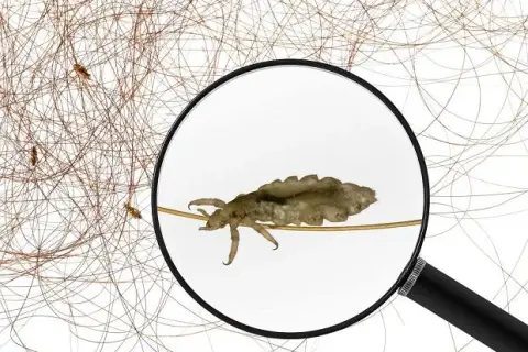 Wszy w snach – co oznaczają? Znaczenie i interpretacja marzeń sennych o wszach